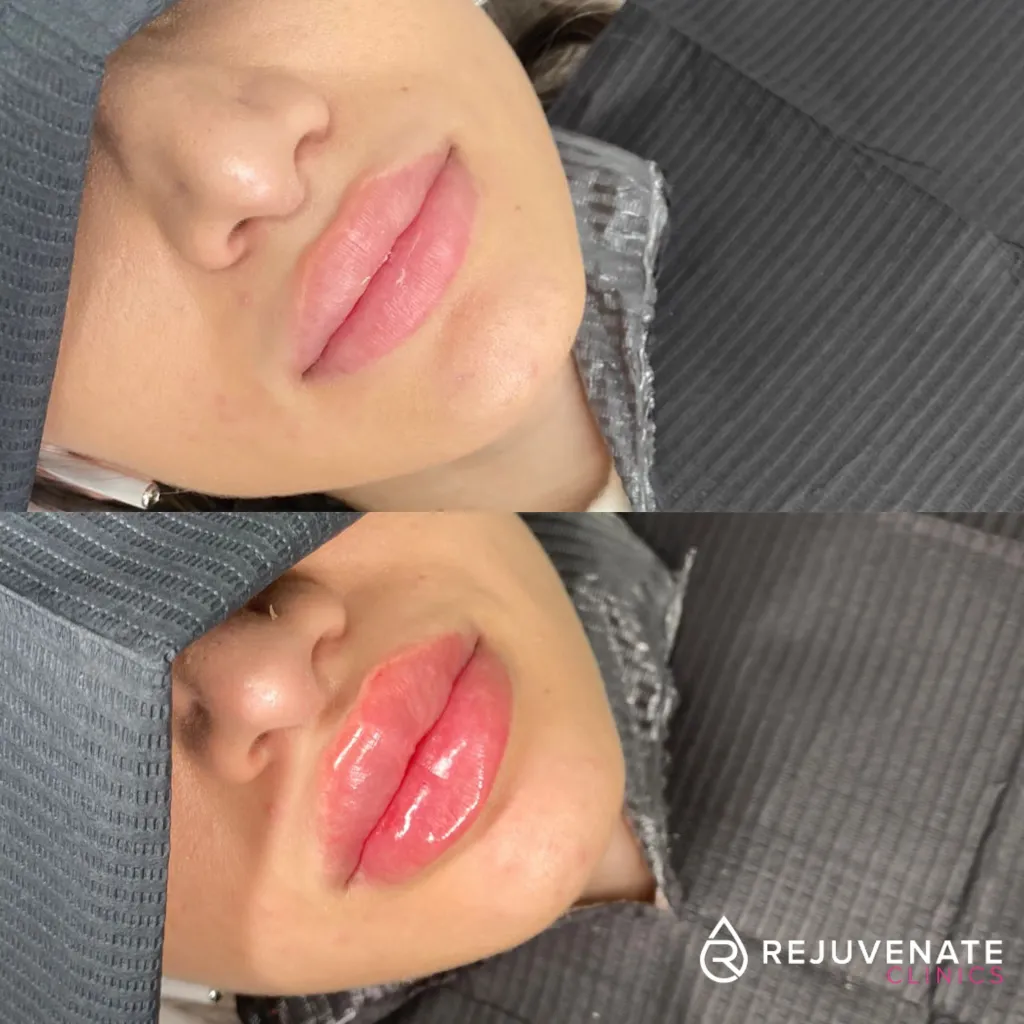 320560702_1230395924488954_3845656108316694334_n