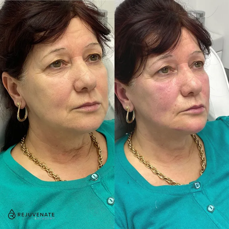 327780023_654312996447918_1629023106202125811_n