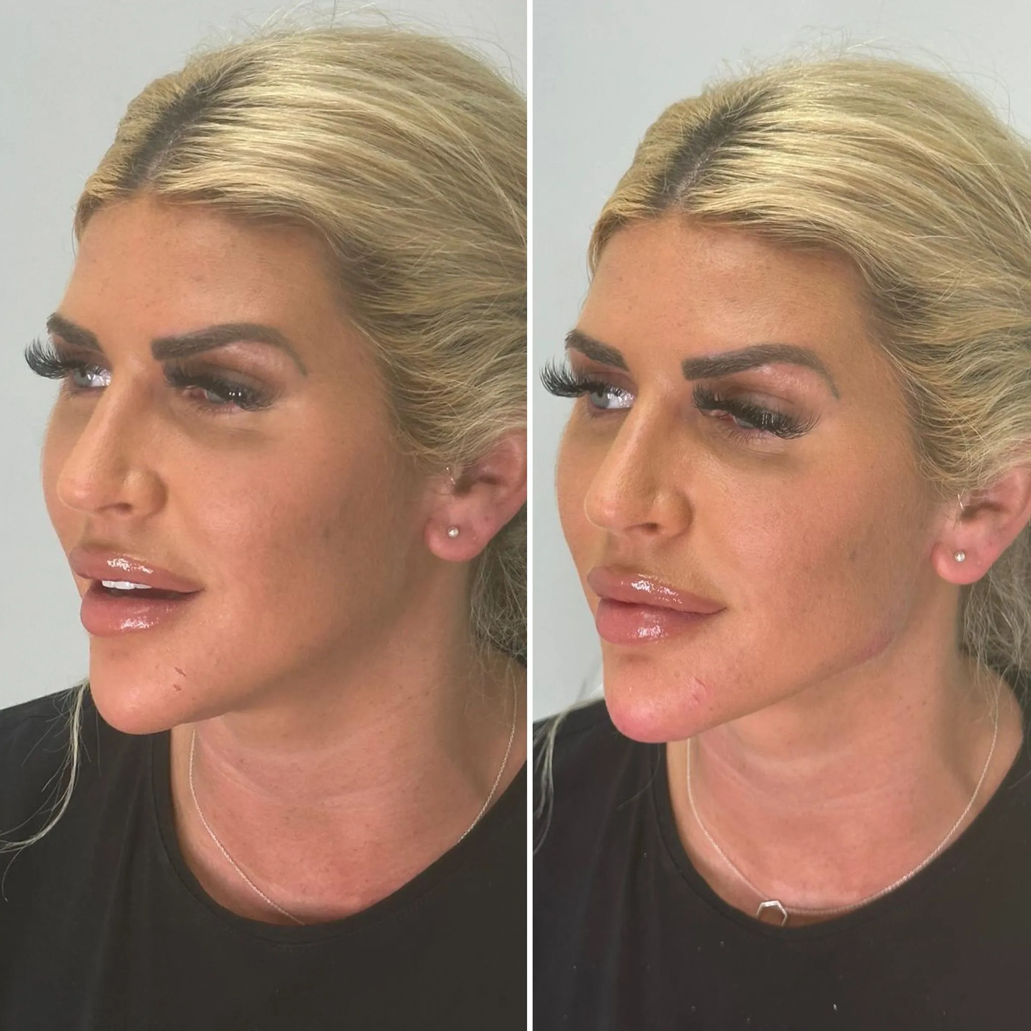 rejuvenate-glow-package